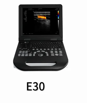 Portátil de ultra-som em cores E30 com abdominal convexo sonda matriz